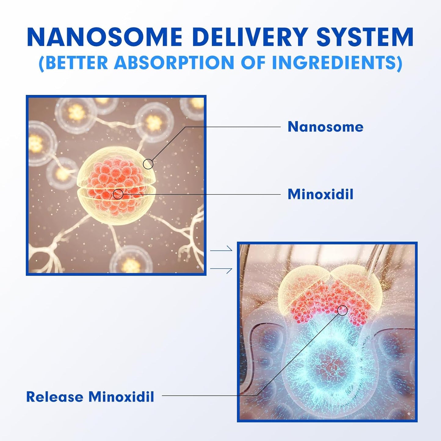 5% Minoxidil for Men Hair Regrowth Treatment, Extra Strength Topical Solution for Thinning Hair & Balding, Beard Growth Enhancer, Non-Greasy Fast-Absorbing Formula, 4-Pack (240ml) 4-Month Supply