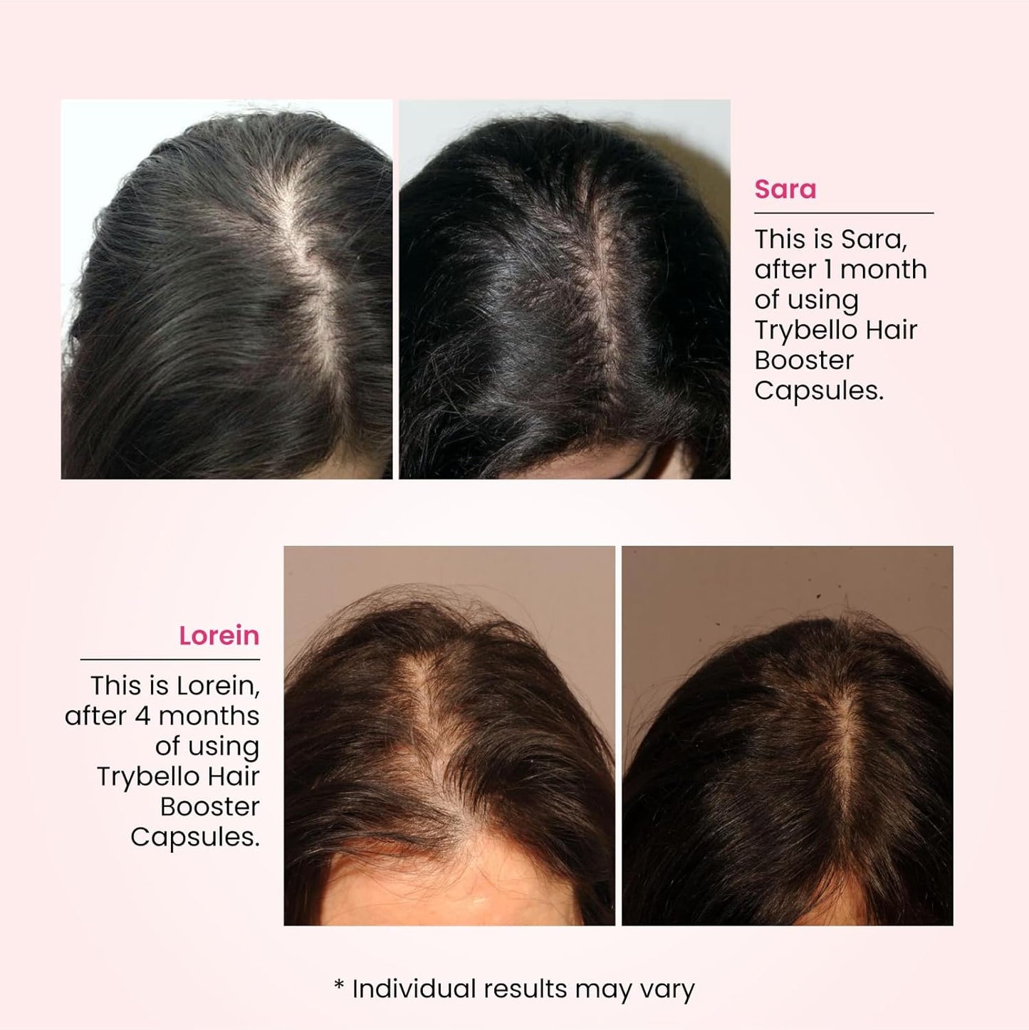 Trybello Daily Hair Booster Capsule - Hair Vitamins for Hair Loss for Women with Biotin & Collagen - Multivitamin for Women, All-Natural Hair Growth Support, Thicker, Fuller Hair Formula - 30 Servings