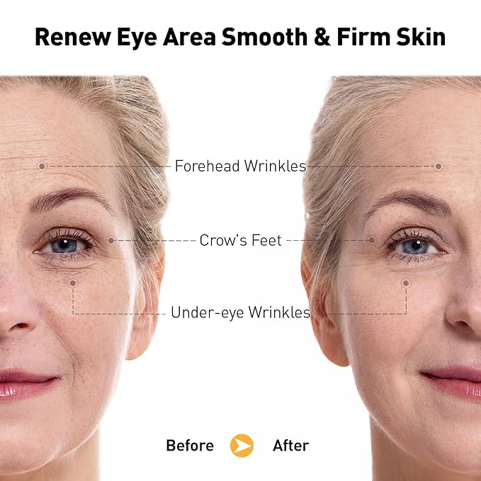 Retinol Eye Cream for Anti-Aging & Wrinkles - Firming & Repair Under Eye Serum with Retinol, Niacinamide, Hyaluronic Acid, Vitamin E & Bifida Ferment Lysate, 0.7 Fl Oz (Pack of 1)