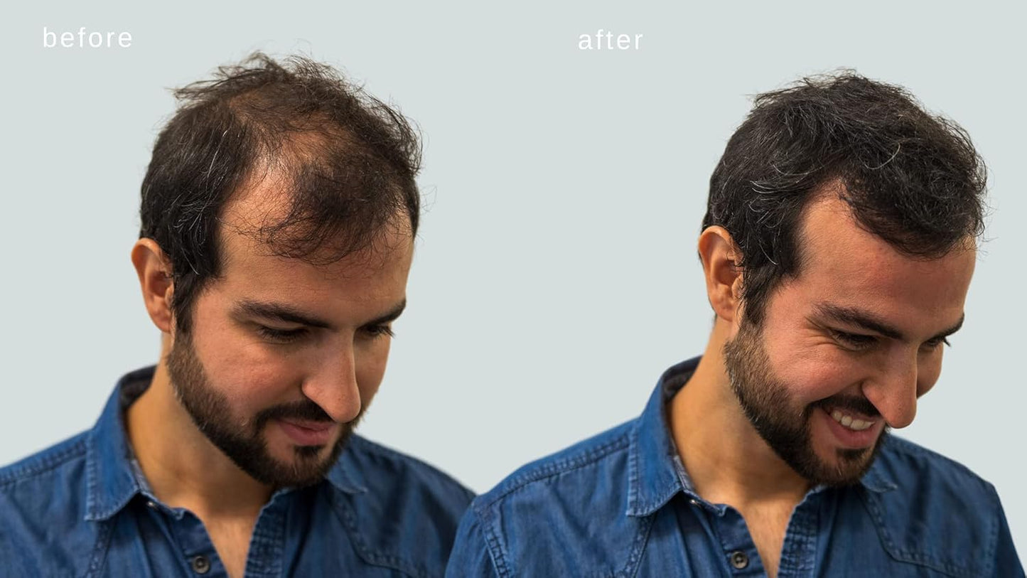 Hair Building Fibers - Volumizing Hair Fibers with real Keratin for Thinning Hair/Hair Loss Dermatologist Tested and Certified Hypoallergenic - 60 days + supply(Dark Brown)