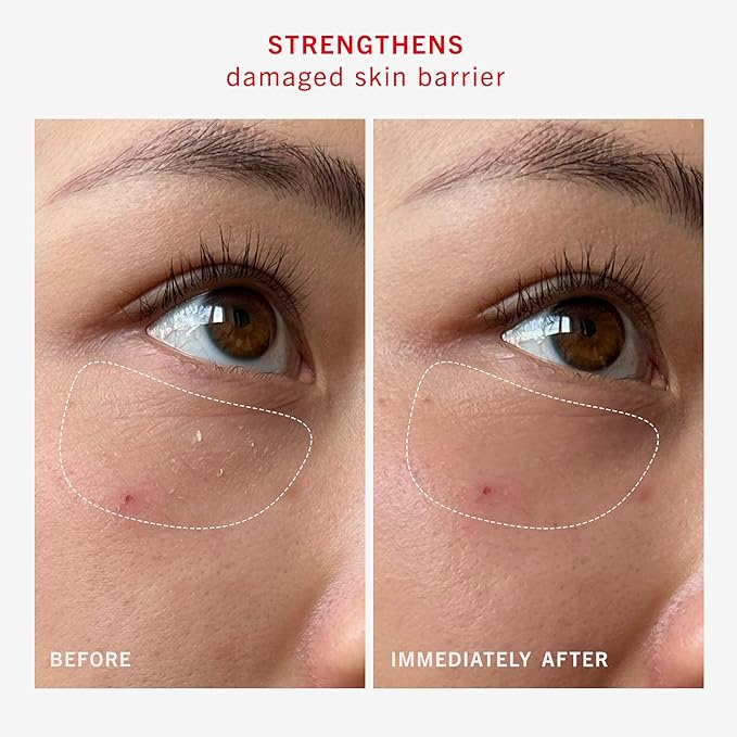 First Aid Beauty - Ultra Repair Rescue Barrier Balm, Deep Hydrating Skin Barrier Mask with 1% Dimethicone, Visible 24-Hour Relief for Dry, Cracked & Chapped Skin, Safe for Sensitive Skin, 2.25 oz