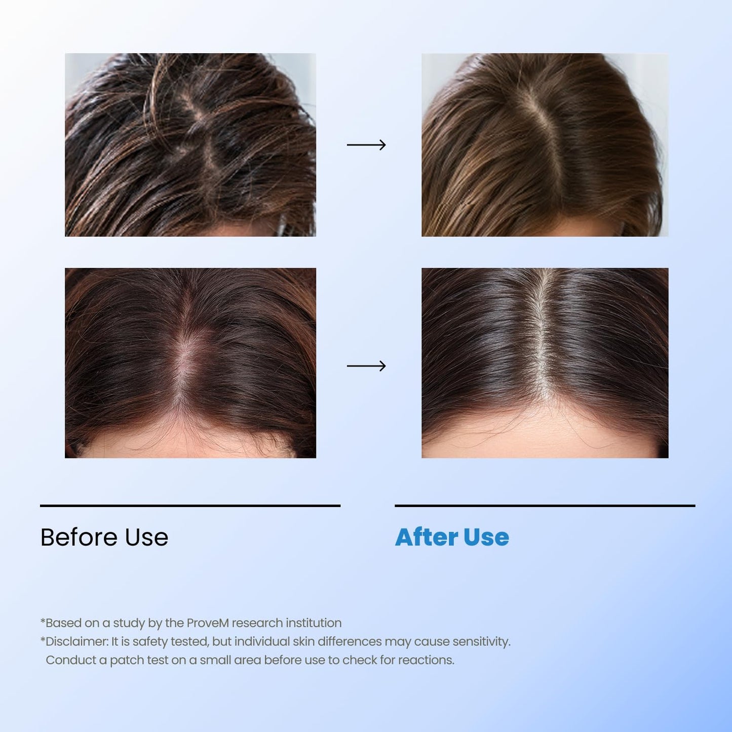 Bubble Tonic — Leave-In Scalp Exfoliator Foam for Oily, Sweaty, or Itchy Roots — Clears Buildup & Sweat with No Residue — Cooling Relief with Menthol & Salicylic Acid | Korean Hair Care Detox