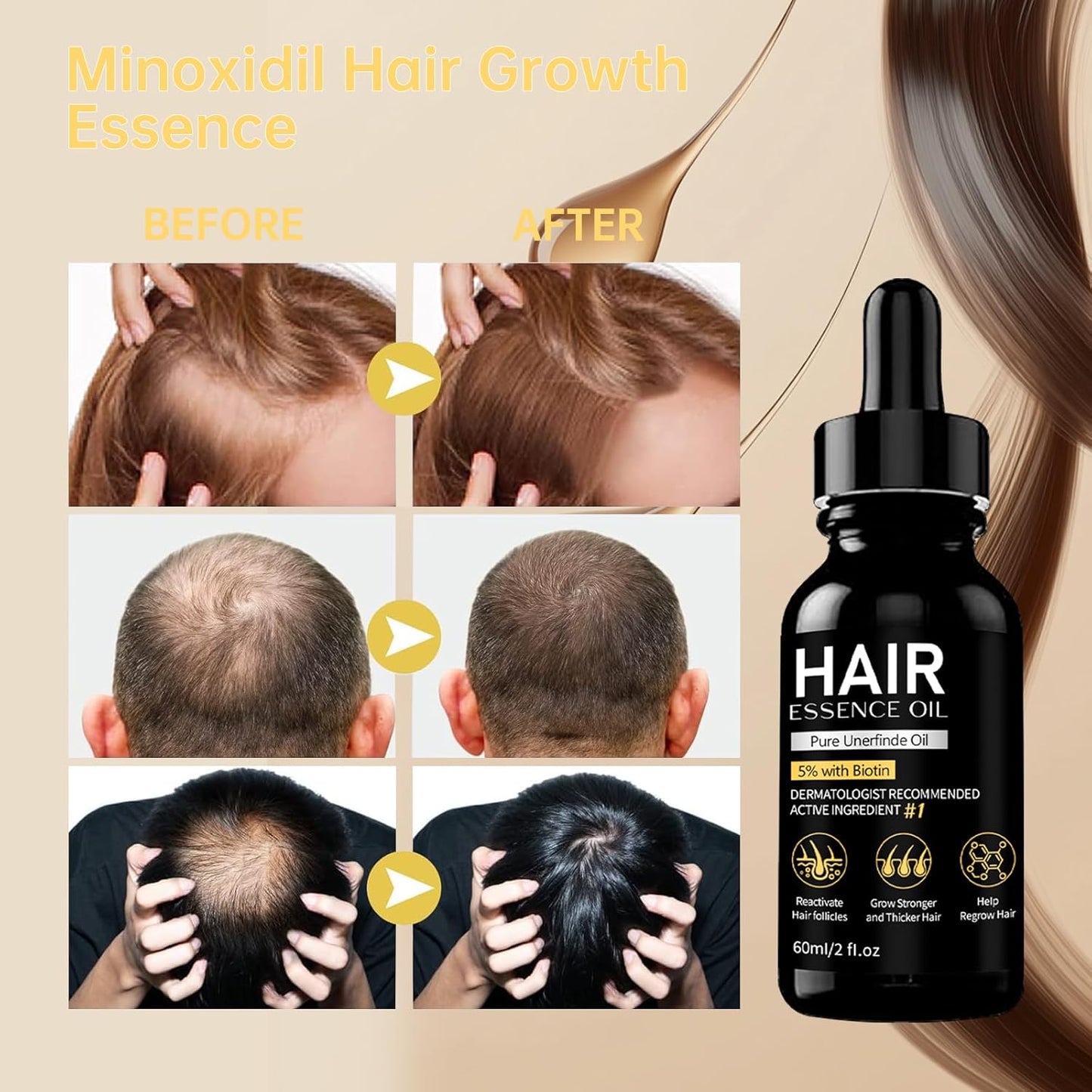 5% Minoxidil Hair Growth Serum, Natural Biotin Hair Oil for Men and Women, 2 fl oz