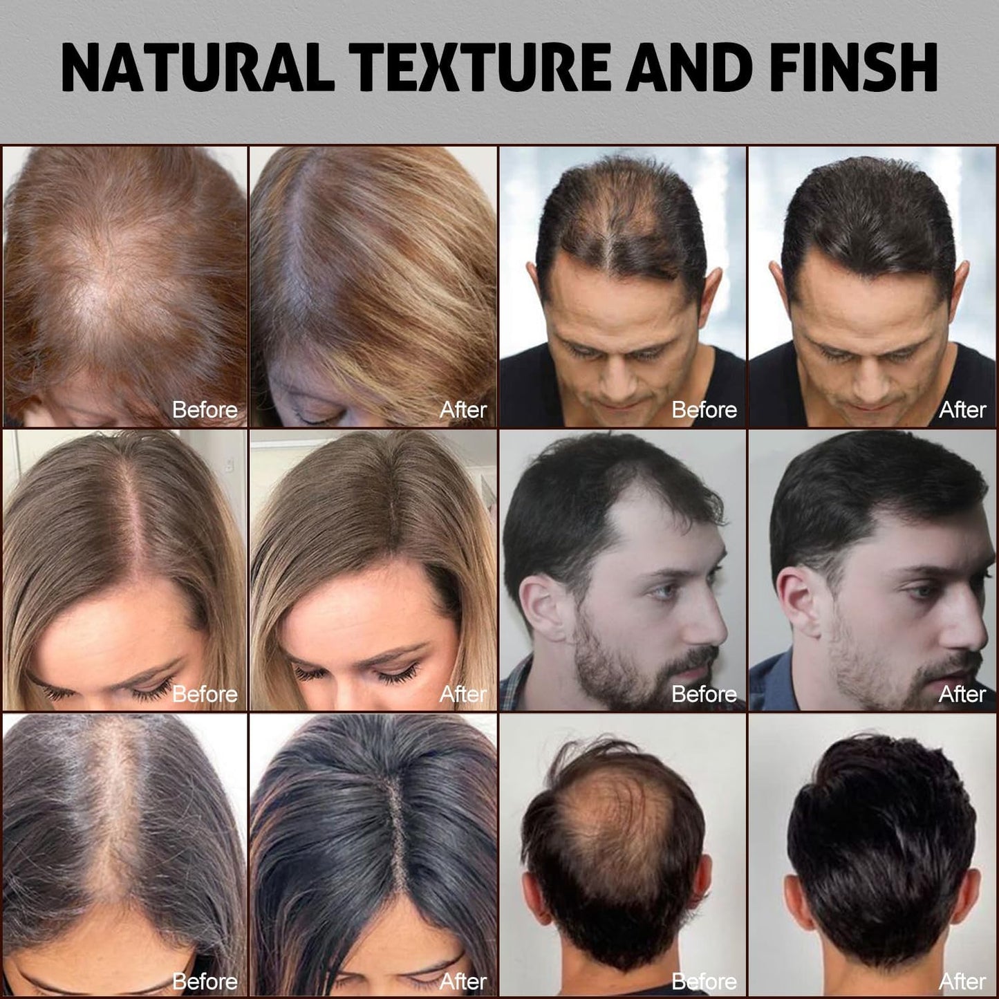 Ustar Hair Building Fibers for Thinning Hair 27.5g Conceals Hair Loss Instantly Thicker Fuller Look 9 Shades for Women & Men 2 Pack (Gray)