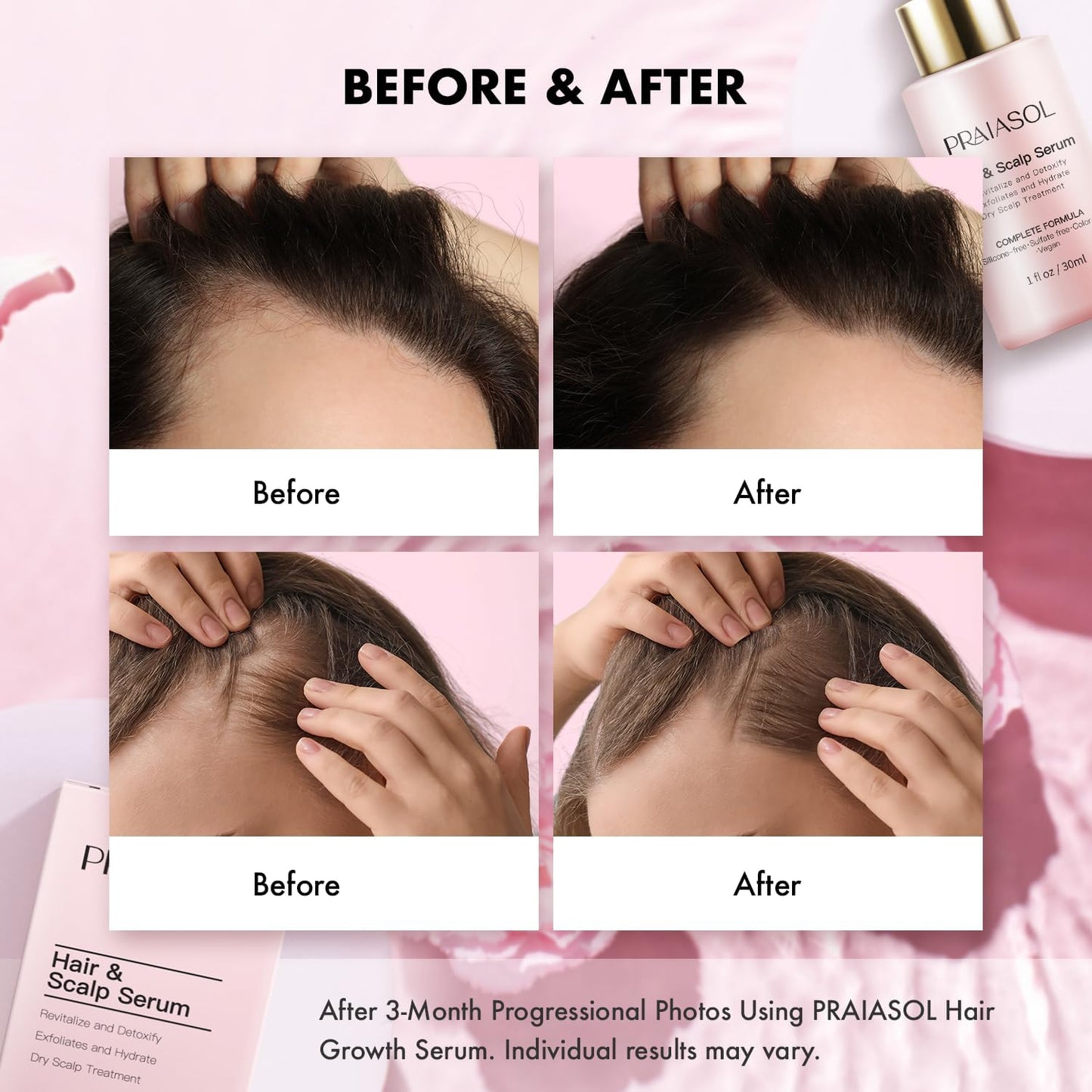 Hair Growth Serum for Women: Scalp Serum for Hair Loss Treatment, Thinning Hair Serum With Biotin,Rosemary & Peptide, Hair Thickening Products