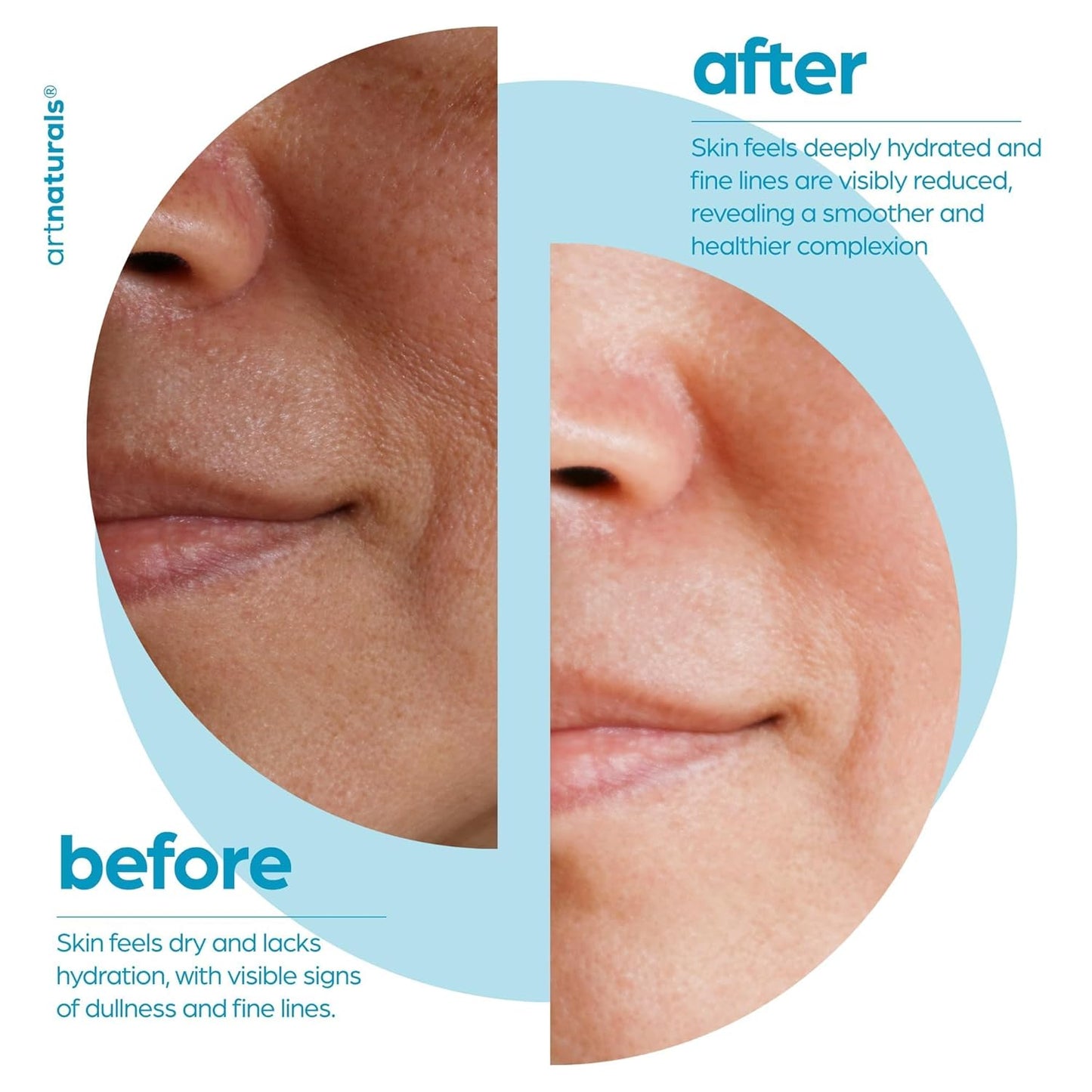 ArtNaturals Hyaluronic Acid Serum - Anti- Aging Facial Serum, Natural Moisturizer w/Vitamin C Serum & Vitamin E - for Skin Care - Reduce Wrinkles & Dark Spots (1 Fl Oz (Pack of 1))