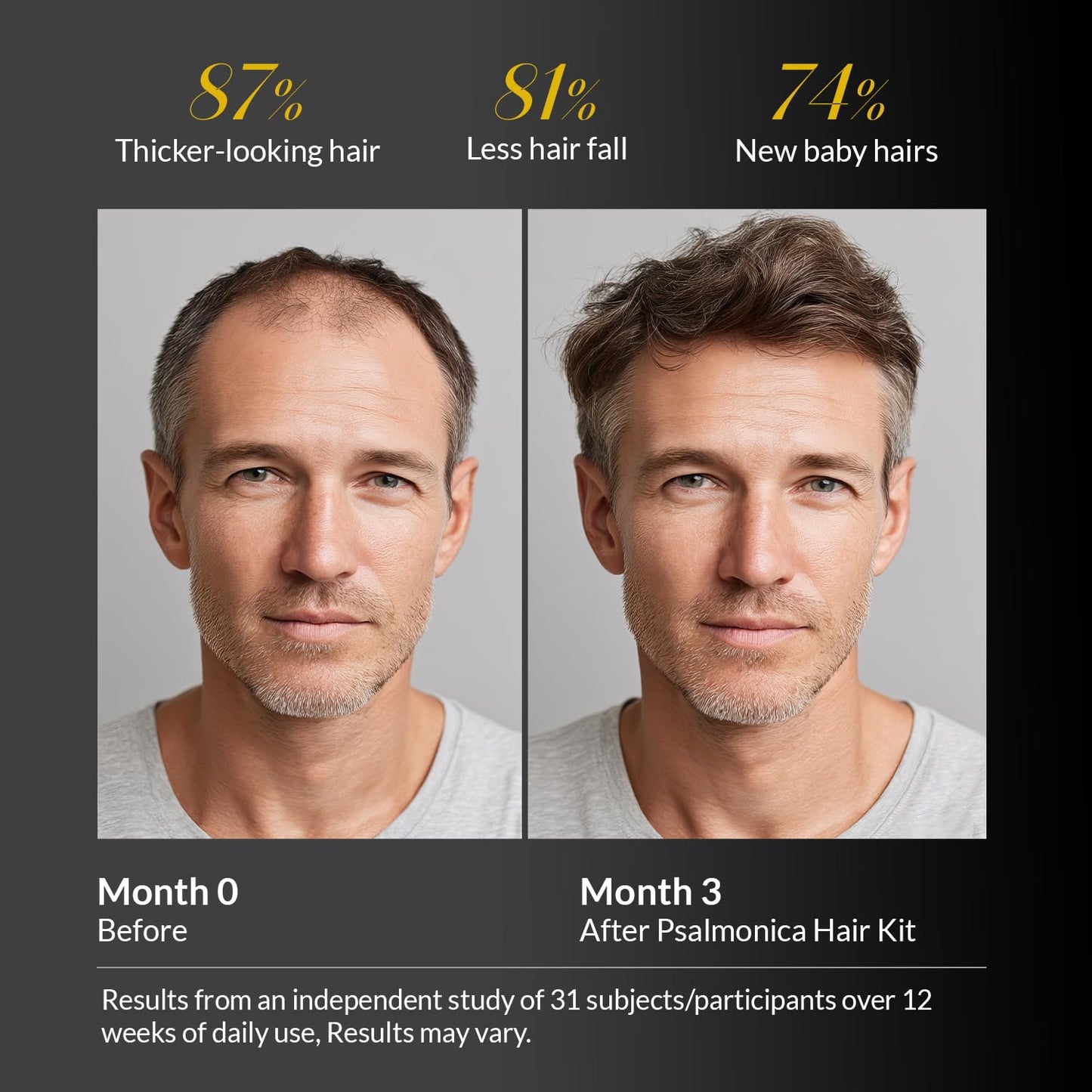 Root Activator Shampoo for Men & Hair Growth Serum Kit: Scalp Care for Hair Loss and Thinning Hair - Natural Hair Loss RegrowthTreatments for Women Men (11.1 Fl Oz (Pack of 1))