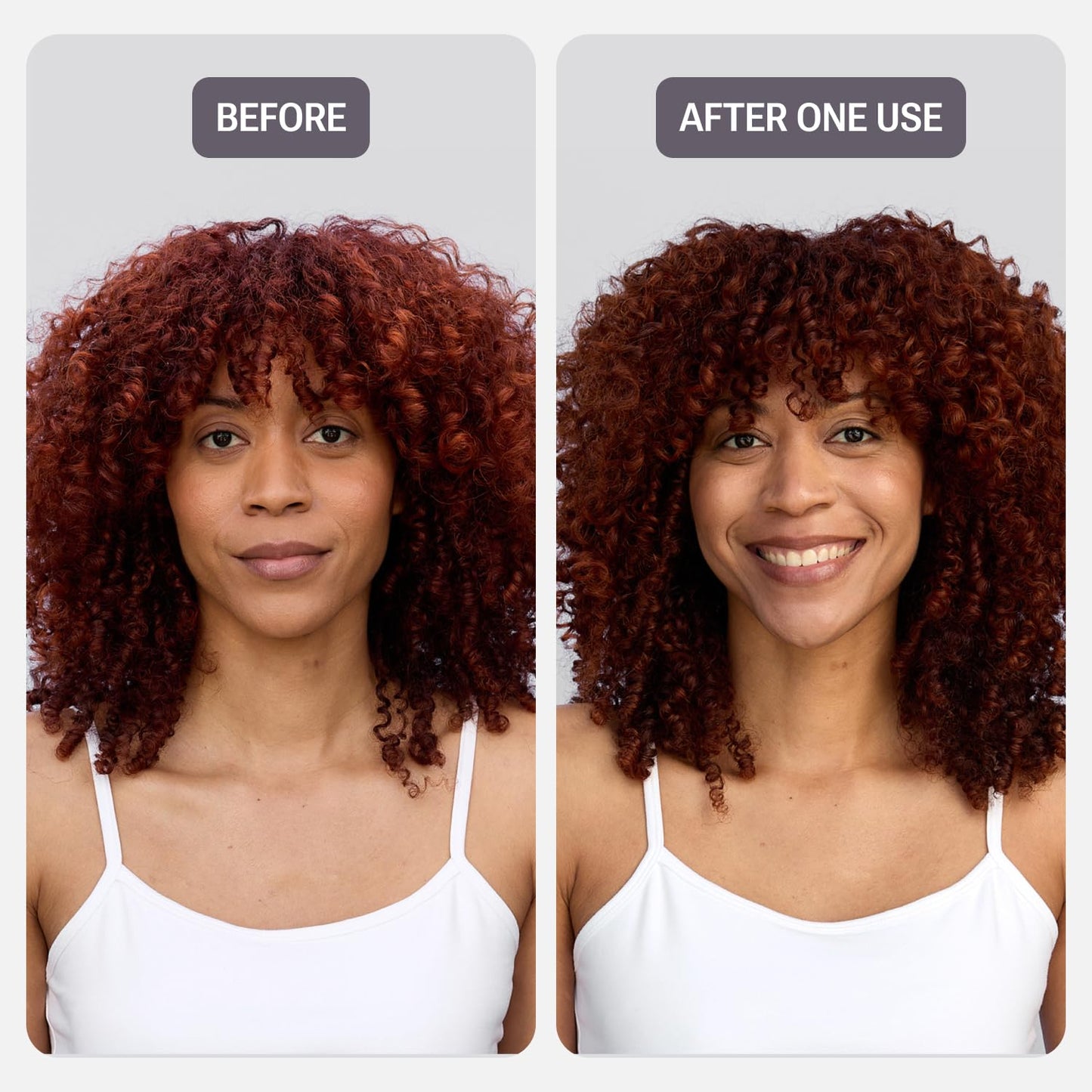 NULASTIN Strength & Shine Hair Duo - Vibrant Scalp Shampoo (10 fl oz) & Vibrant Scalp Conditioner (10 fl oz) - Reduce Frizz, Enhance Volume, and Support Hair Growth (2 Pc)