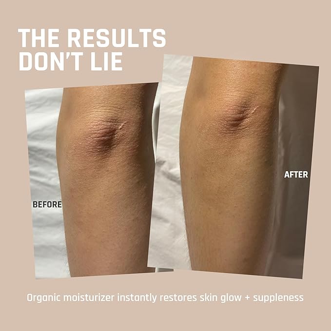 Whipped Beef Tallow for Skin - 100% Pure, Grass Fed Tallow Moisturizer for Face and Body - Organic Honey Beef Balm for Sensitive Skin - Quick Absorbing Hydration (Unscented)