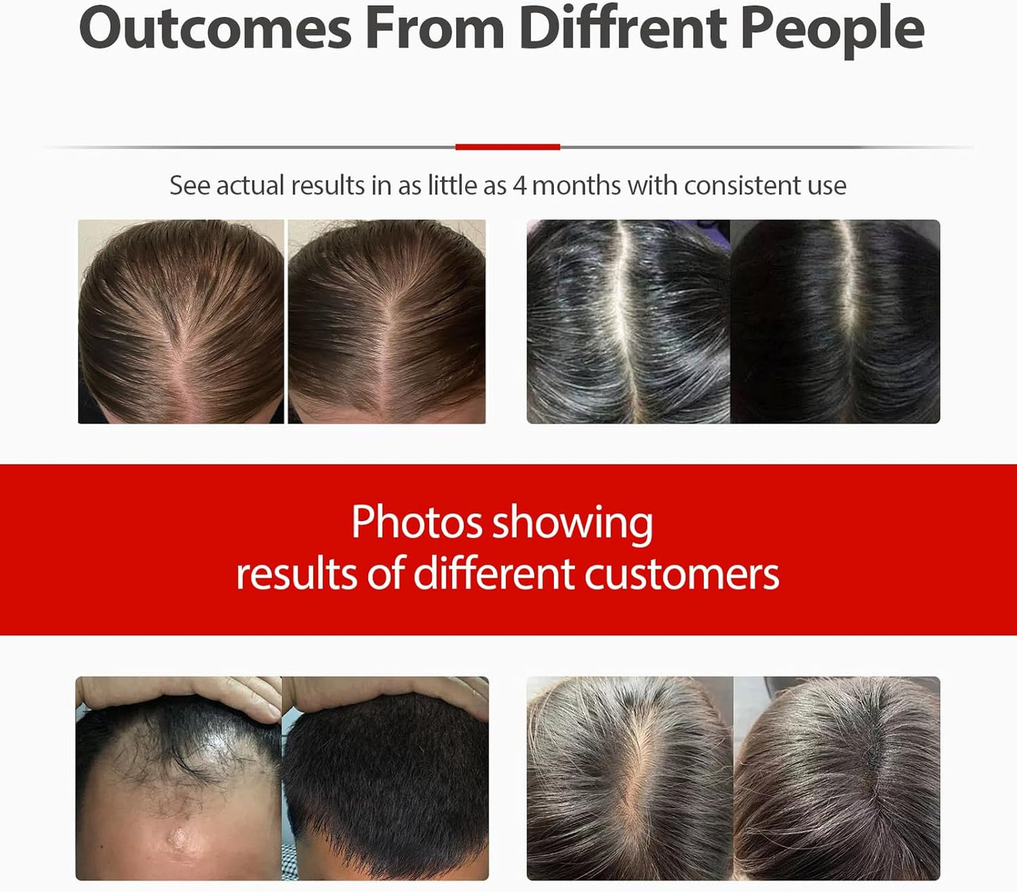 Laser Hair Growth Cap, Red Light Therapy for Hair Regrowth, Laser Therapy Cap for Hair Loss, Hair Loss Treatments Hat for Men & Women with Built-in Battery & Controller