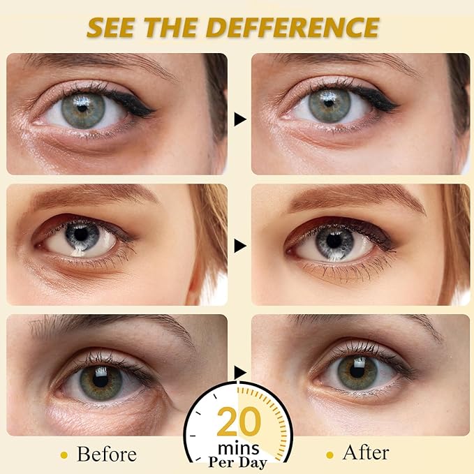 30 Pairs 24K Gold Eye Masks, Collagen Eye Patches for Puffy Eyes and Dark Circles Treatments, Reduce Undereye Bags,Wrinkles, Gel Eye Skin Care Pads, Beauty Gifts for Women
