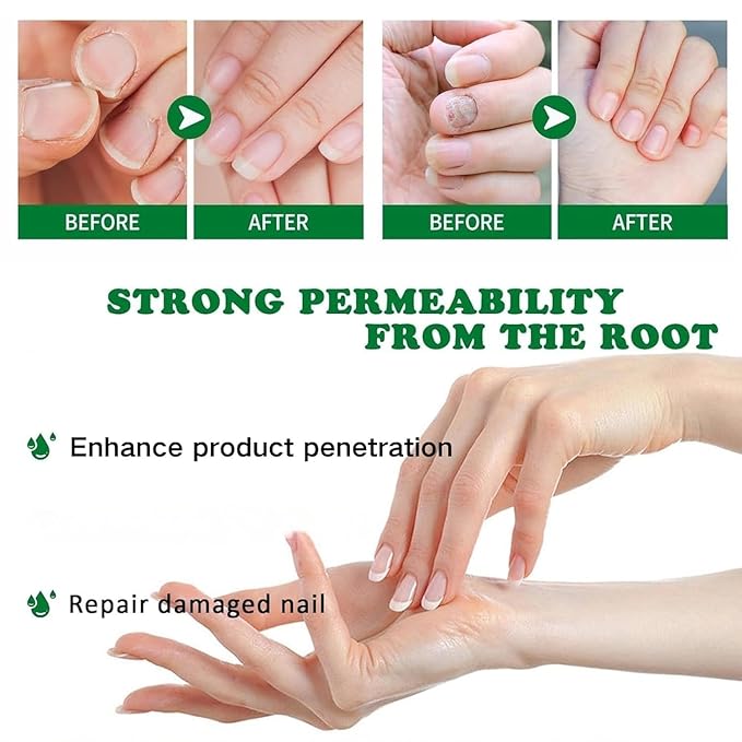 3PCS Ginger Nail Care Serum - Moisturize the Cuticle & Strengthen Nails and Helps Nails Healthy Grow