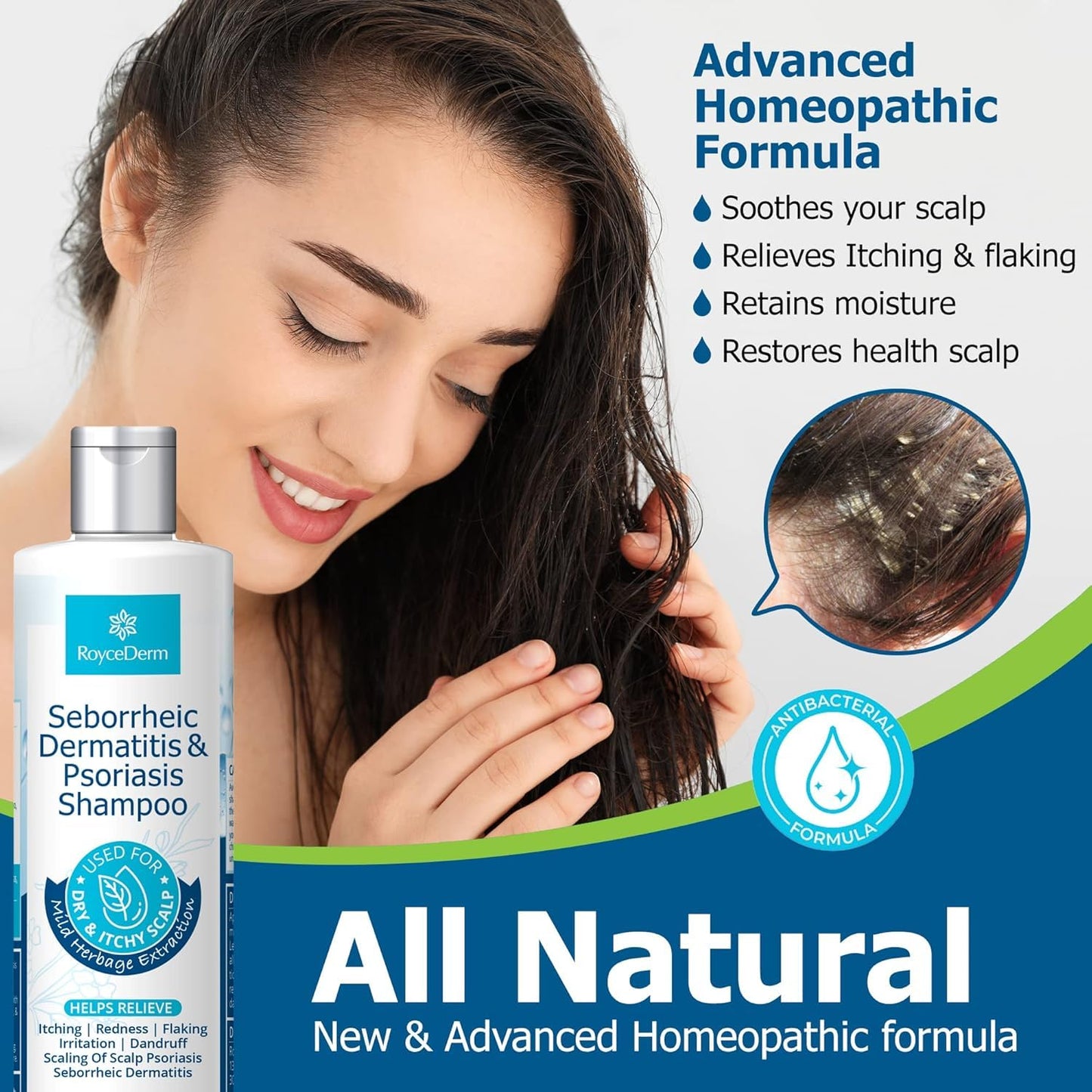 Roycederm Psoriasis Shampoo, Seborrheic Dermatitis Shampoo, Folliculitis Shampoo, Dandruff Shampoo, Scalp Psoriasis & Seborrheic Dermatitis Treatment, Dry Itchy Scalp Treatment