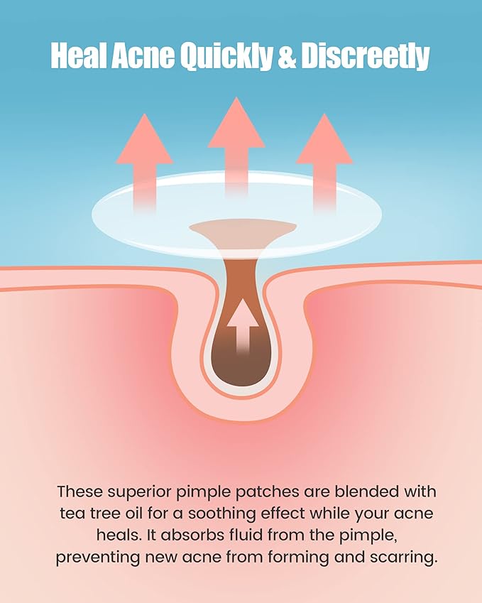 Pimple Patch 420 Counts 4 Sizes, Hydrocolliod Acne Patch for Face, Invisible Zit Patch with Tea Tree Oil & Calendula Oil, Blemish Patch, Vegan and Cruelty Free