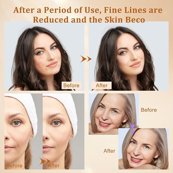 Hotodeal LED Face Mask Light Therapy,7 Colors Light Therapy for Face & Neck Mask,Skin Rejuvenation Anti-aging Beauty LED Mask,Silicone Material Foldable for Easy Carrying