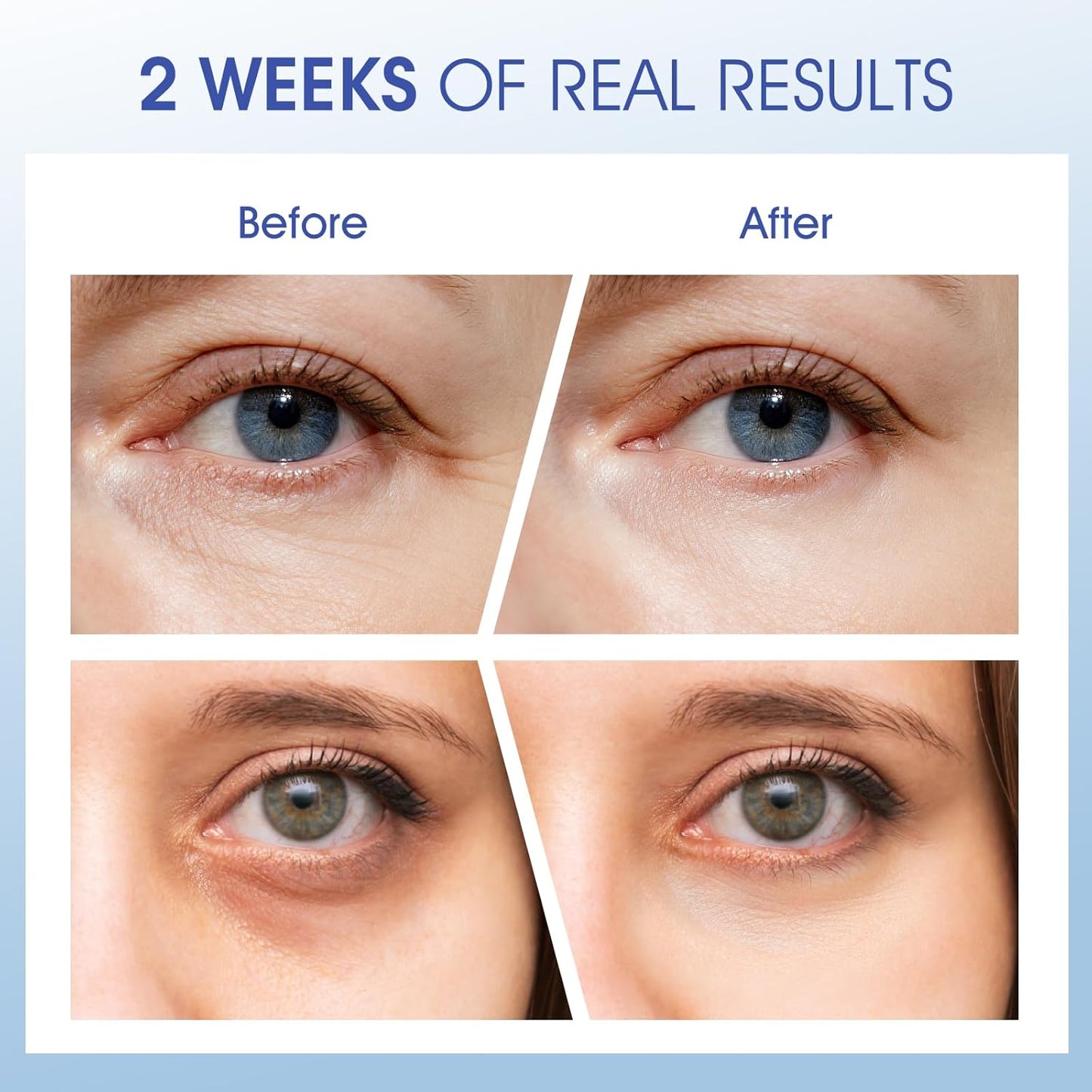 Eye Cream for Wrinkles, Fine Lines & Crows Feet - With Ceramides, Peptides + Caffeine + Niacinamide - Anti Aging Skin Renewing Under Eye Cream for Men and Women, 0.5 Oz