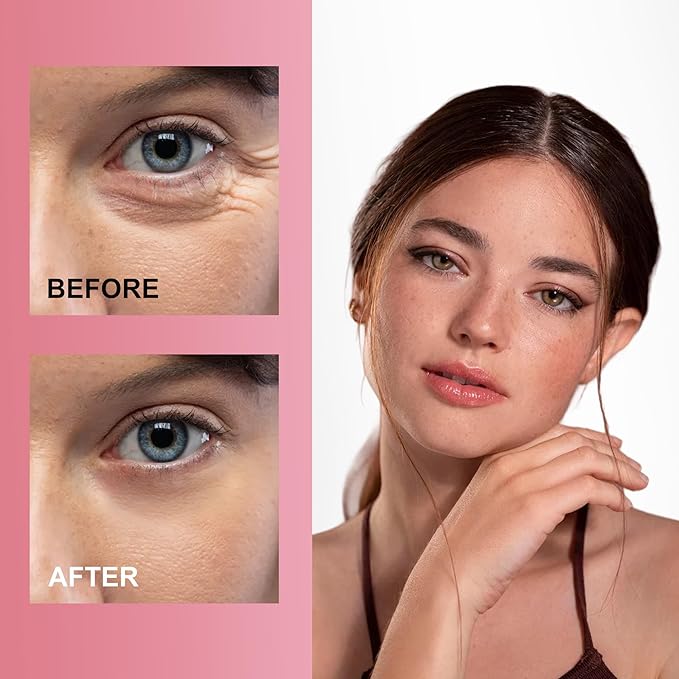 Reusable Wrinkle Patches - Silicone Fusion Treatment Forehead Patches for Brow Lift, Wrinkle Smoothers, Reduce Frown Lines & Face Lift - 3 Pack (Eye)