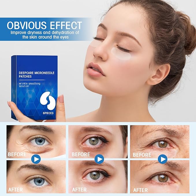 Malora Microglow Eye Patches, Malora Eye Patch, Microglow Patches, Everver Glowup Deep Care Microglow Patches, Women Face Wrinkles Deep Care Microglows Mask Set for Hydration & Soothing(1 Box)