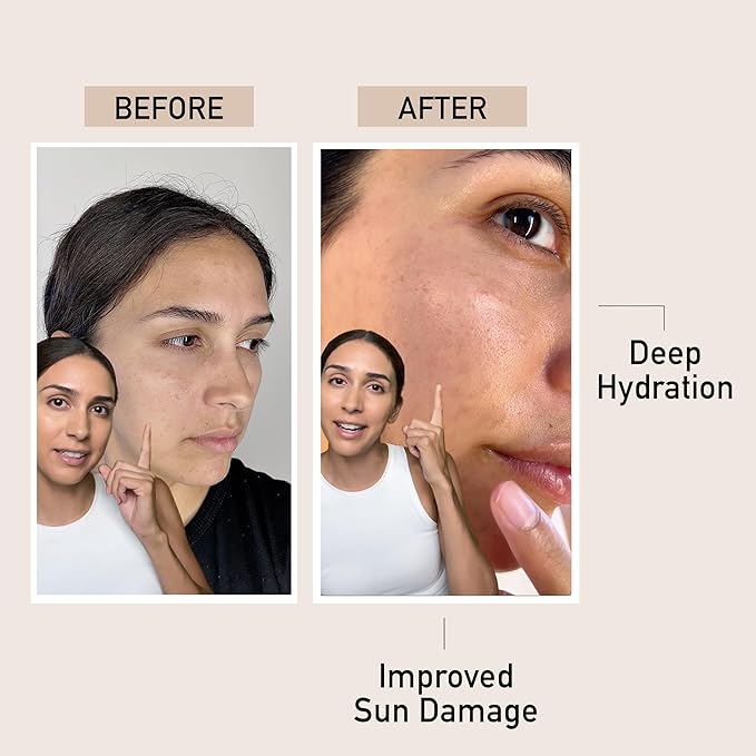 Hydrating Lycopene Tomato and Hyaluronic Acid Serum for Face and Neck, Olive Squalane and Moringa Skincare for Smooth Skin, Lightweight and Non-Greasy Formula for All Skin Types