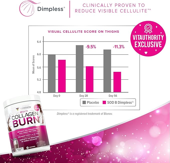 Vitauthority Collagen Peptides Powder Weight Loss Supplements | Hydrolyzed Beauty Complex for Women, Hair Skin Nails | Fat Burning Support | Chocolate Flavored 25 Servings