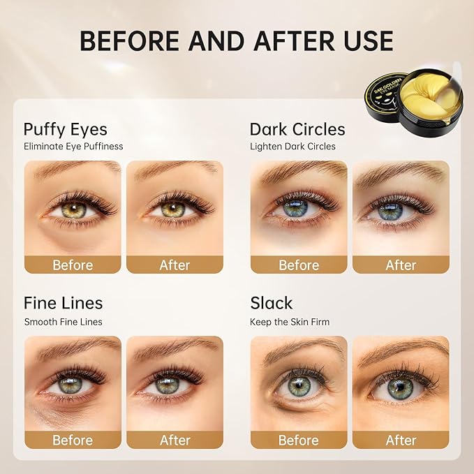 PITHER Under Eye Patches for Dark Circles, Eye Masks for Puffy Eyes Wrinkles Under Eye Bags Firmness 30 Pairs Skin Treatment Pads with Hyaluronic Acid and Collagen Women Men (Gold)