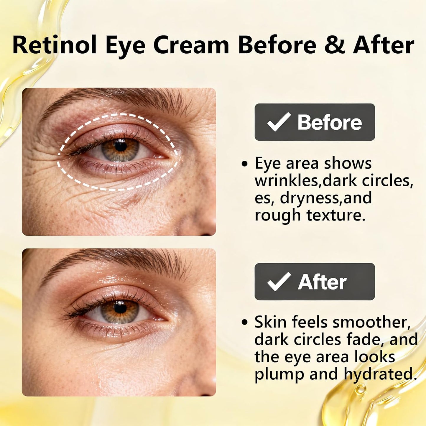 Retinol Under Eye Cream,Vitamin E & Niacinamide – Reduces Appearance of Wrinkles & Dark Circles&Puffiness, Anti-Aging Eye Cream for Fine Lines,Daily & Night Use,Men & Women (1 fl.oz)