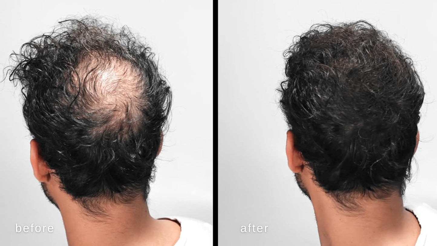 LUXE Hair Building Fibers - Thickening Fibers - CONFIDENCE IN A JAR – 2 Months+ Supply! – Hypoallergenic, Dermatologist Tested – Multiple Colors Available (Light Brown)