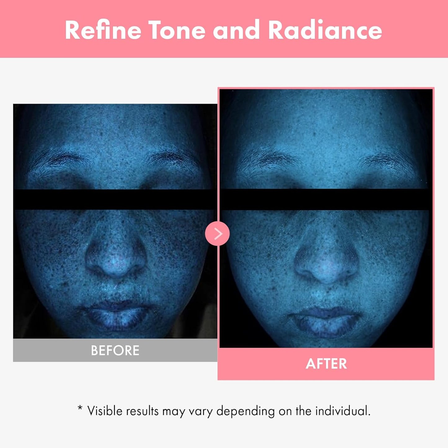 TOSOWOONG PDRN Hyaluron Face Cream, 5,000ppm Salmon DNA, Niacinamide, Hyaluronic Acid and Panthenol Moisturizer for Hydrating & Firming, Uneven Skin Tone Care, Korean Skincare, 50ml / 1.69 fl. oz.