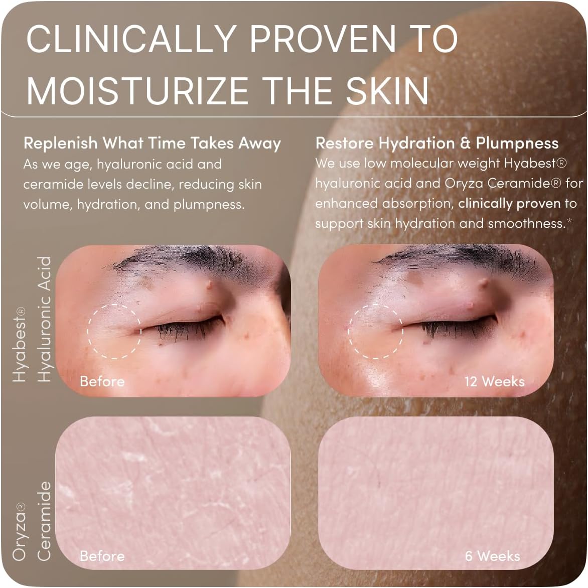 GLOW Anti Aging Supplement - Hyabest® Hyaluronic Acid, Phytoceramides, 5000 mcg Biotin, Vitamin A, C, E, Zinc - Hair Skin Nails Vitamins for Women & Men - Wrinkles & Skin Hydration - 60 Capsules