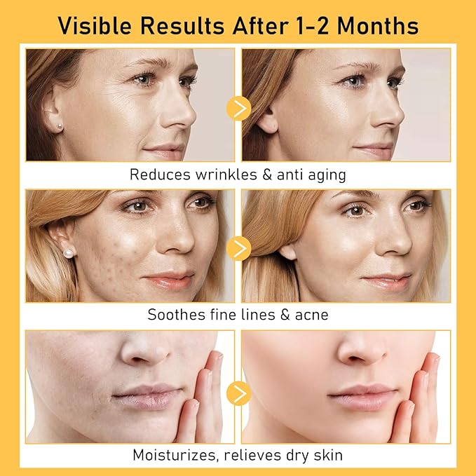 Argireline Serum For Oily Skin, Advanced Anti-Wrinkle Facial Serum For Women, 30 ML/ 2 PCS Moisturizing Argireline 10% Solution For Face, Argireline Peptide.