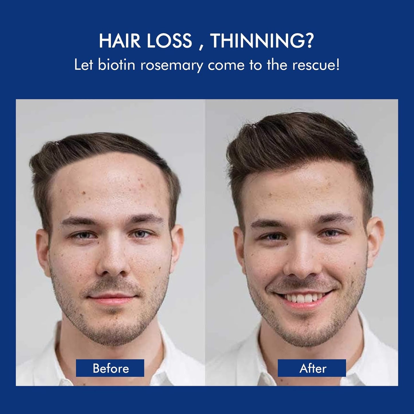 Ceson&Cesun Rosemary & Biotin Hair Growth Thickening Shampoo for Men | Anti-Thinning Hair Strengthening | Hydrate Cleanse Hair & Scalp | Hair Regrowth Shampoo, Dry Damaged Hair Care For Men and Women