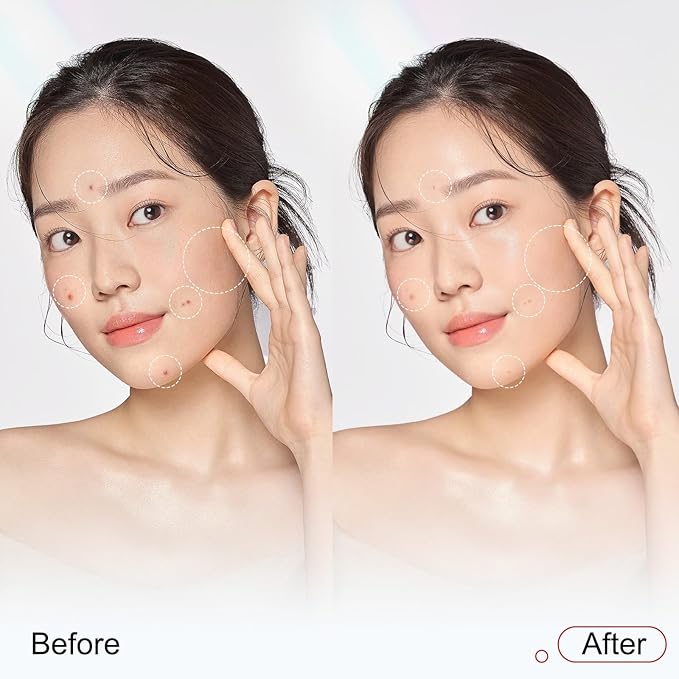 Niacinamide Serum 10%, 377 1% Dark Spot Corrector, Vitamin C Face Serum for Uneven Skin Tone, Pores Reducer, Facial Soothing Moisturizer, Korean Skin Care 30ml/1.01 fl. oz