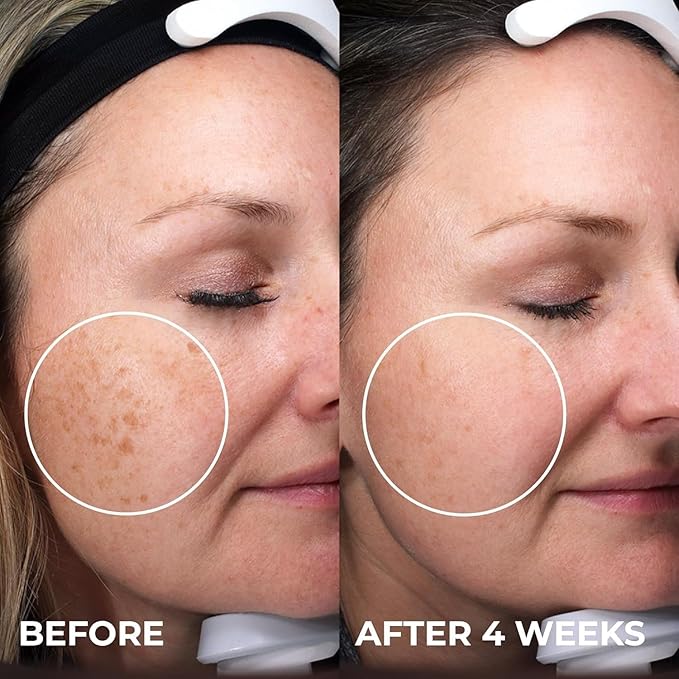 ABERA Saffron Serum For Melasma Treatment, Renewing for Face, Anti-Aging Treatment for Fine Lines & Wrinkles, High Potency Saffron Extract, Hydrating Serum, Dark Spot Remover (2 BOXES)