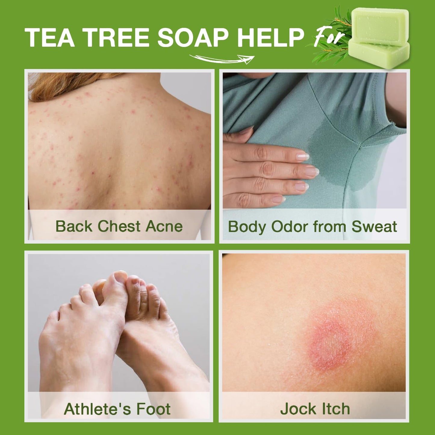 Tea Tree Antifungal Soap Bar – Body Wash for Face & Body Acne, Folliculitis, Jock Itch, Ringworm, Athlete’s Foot, Body Odor, Eczema – 2×4.1 oz