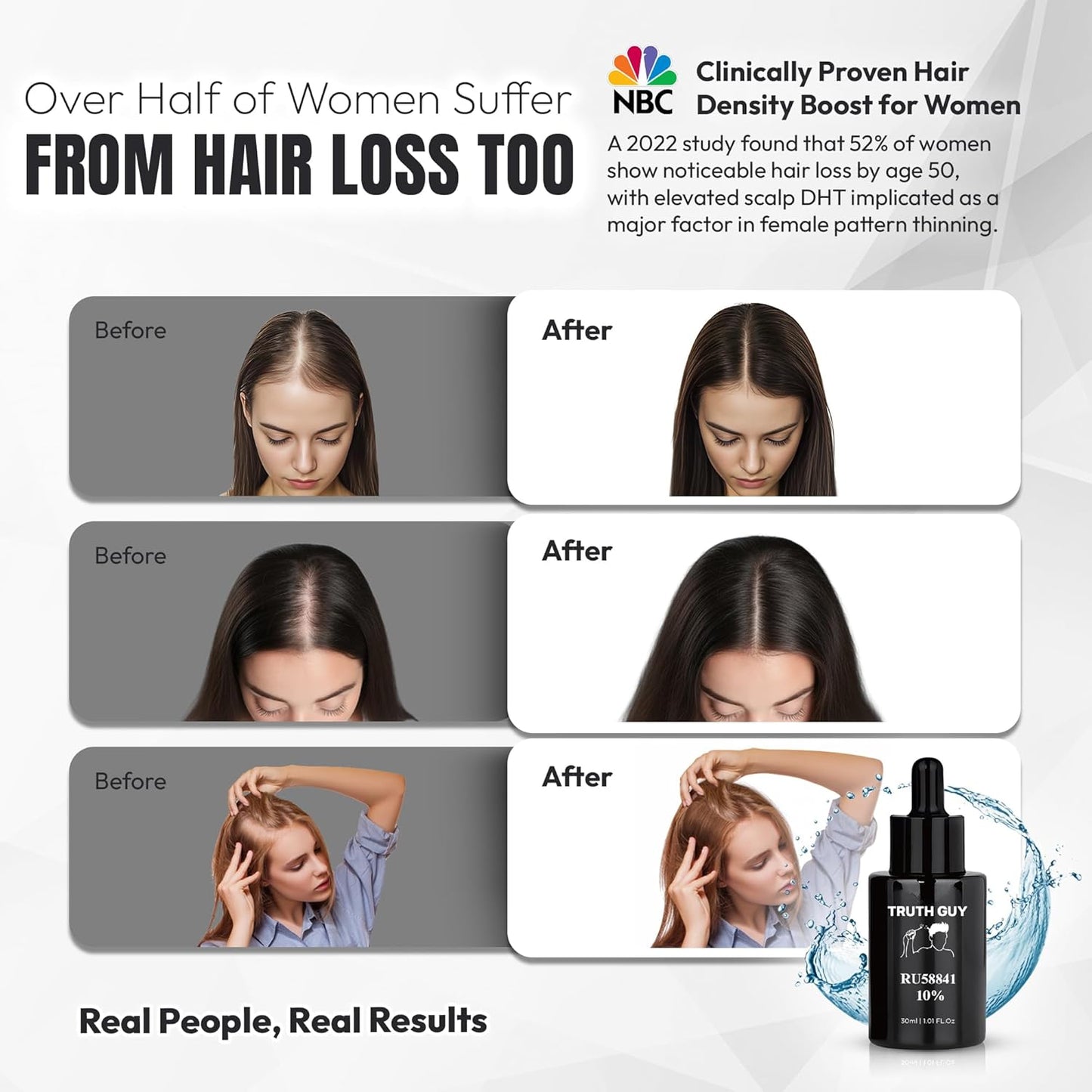 Truth Guy RU58841 10% Hair Serum for Men – Powerful DHT Blocker with Maximum Strength – Targets Male Pattern Thinning and Receding Hairline – Promotes Fuller, Healthier-Looking, Stronger Hair – 30 ml