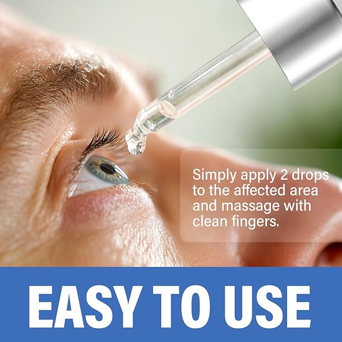 ITECFREELY Stye Eye Treatment, Natural Stye Eye Relief Drops Serum for Styes Chalazion and Blepharitis, Fast Chalazion Remover for Restore Healthier Skin(1 Fl.oz)