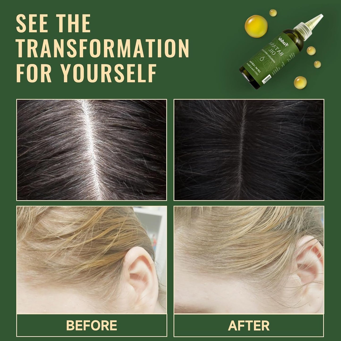 Batana Oil - Dr Sebi Organic Oil for Hair Growth, 100% Raw Pure Natural from Honduras, Deeply Nourishing Scalp for Thicker & Stronger Hair, 8.11 fl oz