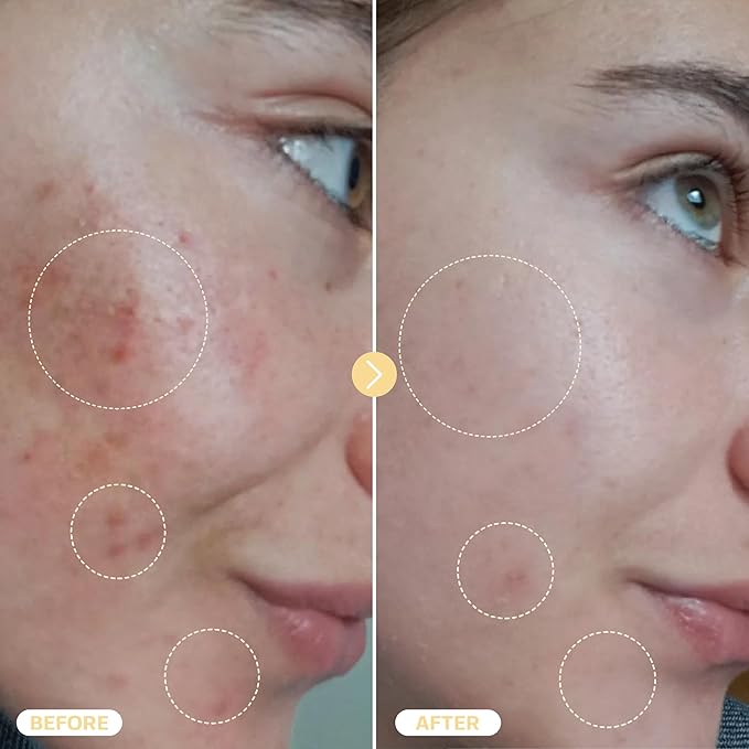 BASE LABORATORIES Hypochlorous Acid Spray for Face & Skin - Travel Size - Magic Facial Toner Spray & Cleaner - Skin Repair Solution helps reduce redness, acne - HOCL Molecule Spray 4oz (2 x 2oz) - 2PK