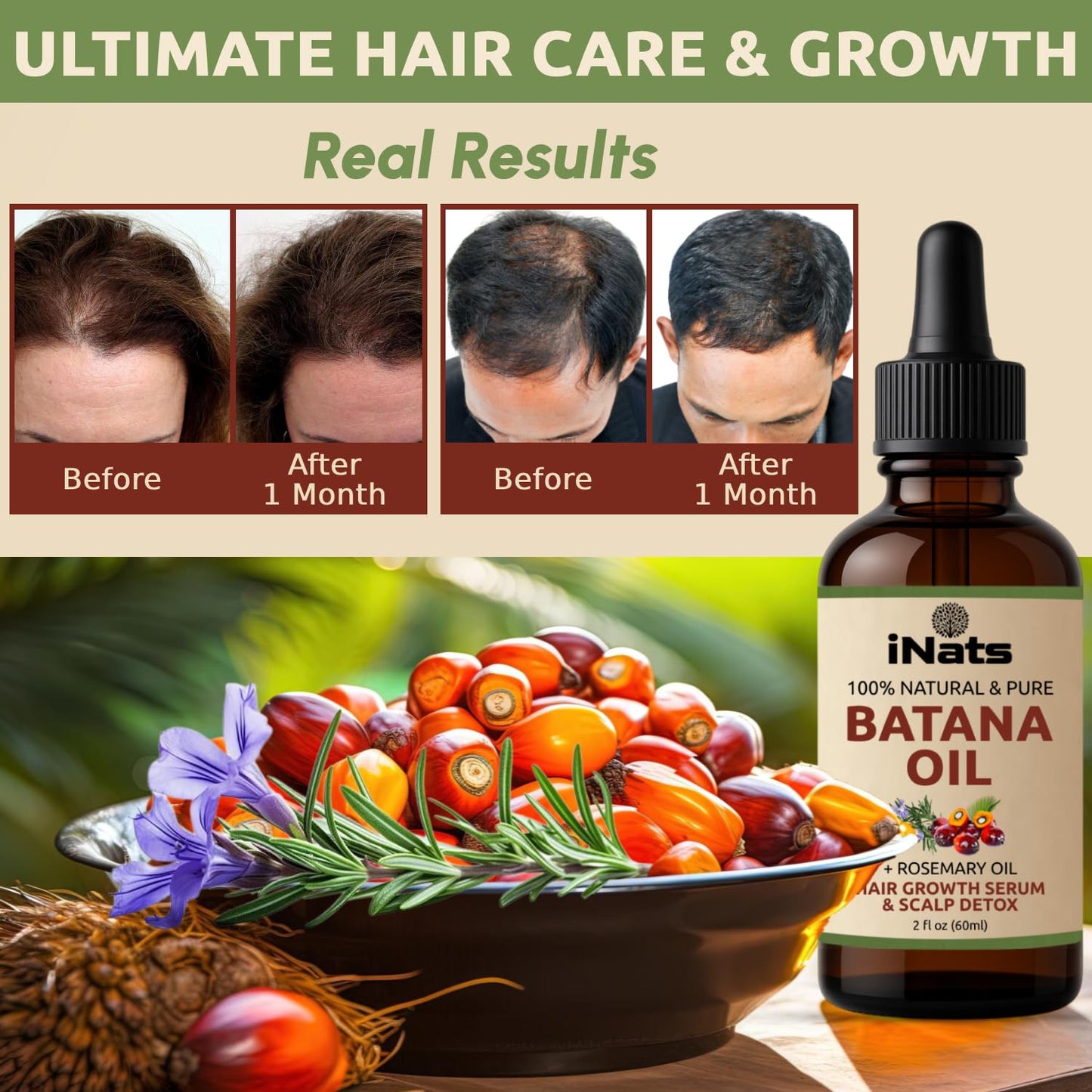 Batana Oil for Hair Growth with Rosemary: Nourish & Detox Scalp for Thicker, Stronger, Longer Hair - Dr. Sebi Recommended, 100% Organic Batana Oil from Honduras - Reduce Hair Loss (2 Fl Oz)