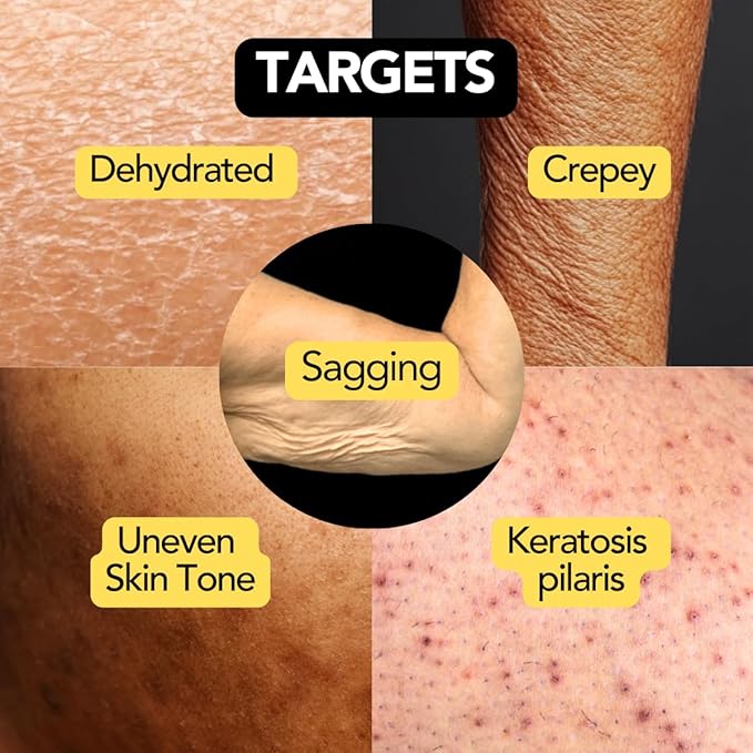 Ultra-Size Firming Retinol Body Lotion for Crepey Skin & Keratosis Pilaris with 0.05% Retinol, AHA, Collagen, Body Cream, Anti Aging Moisturizer 10.14 fl oz