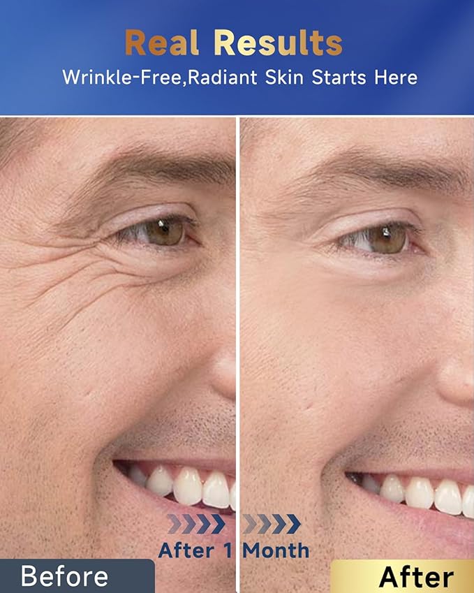 6-in-1 Face Cream for Men, Mens Face Moisturizer, Anti-Aging Face Cream for Men with Retinol Collagen & Hyaluronic Acid, Eye Bags & Dark Spot Remover, After Shave Lotion 2-Pack