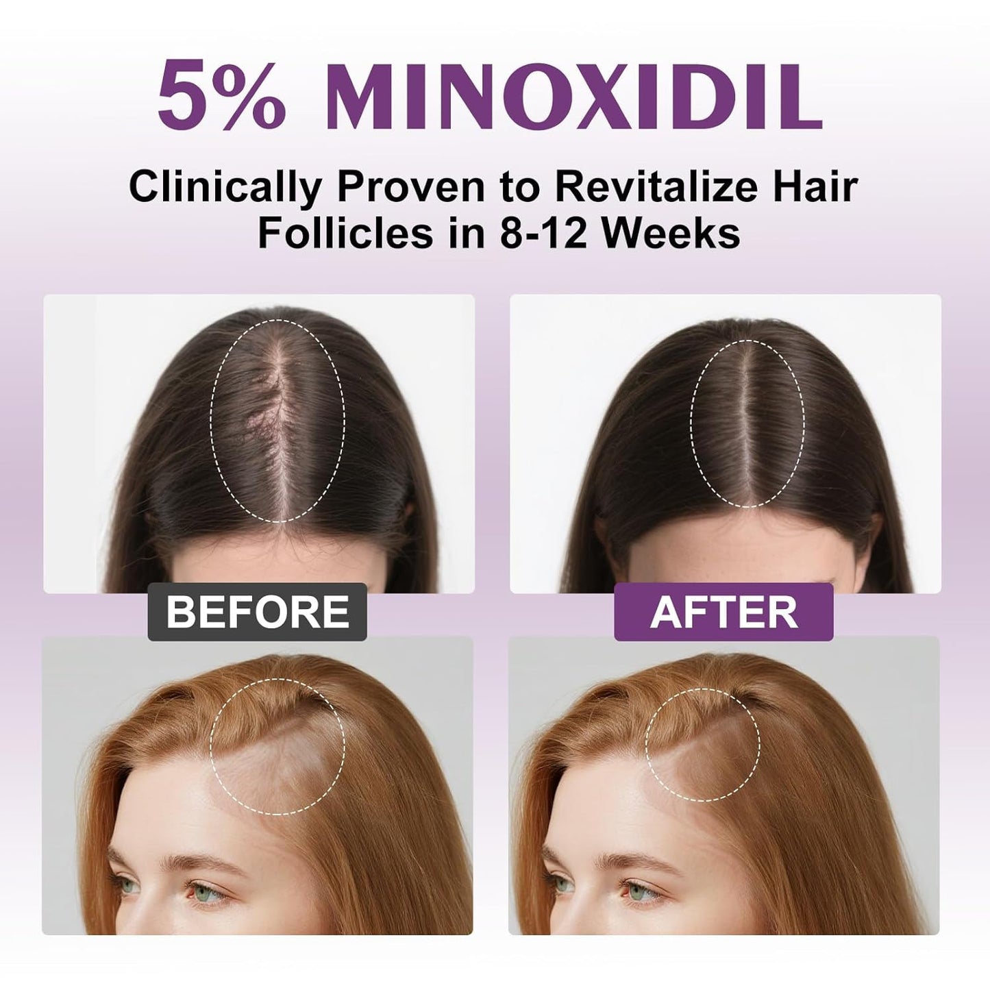 5% Minoxidil Spray for Women-4 PCS ，monoxide for men hair Infused with Biotin, hers hair regrowth treatment, Supports Thicker and Fuller Hair & Beard (13oz, 7 Month Supply)