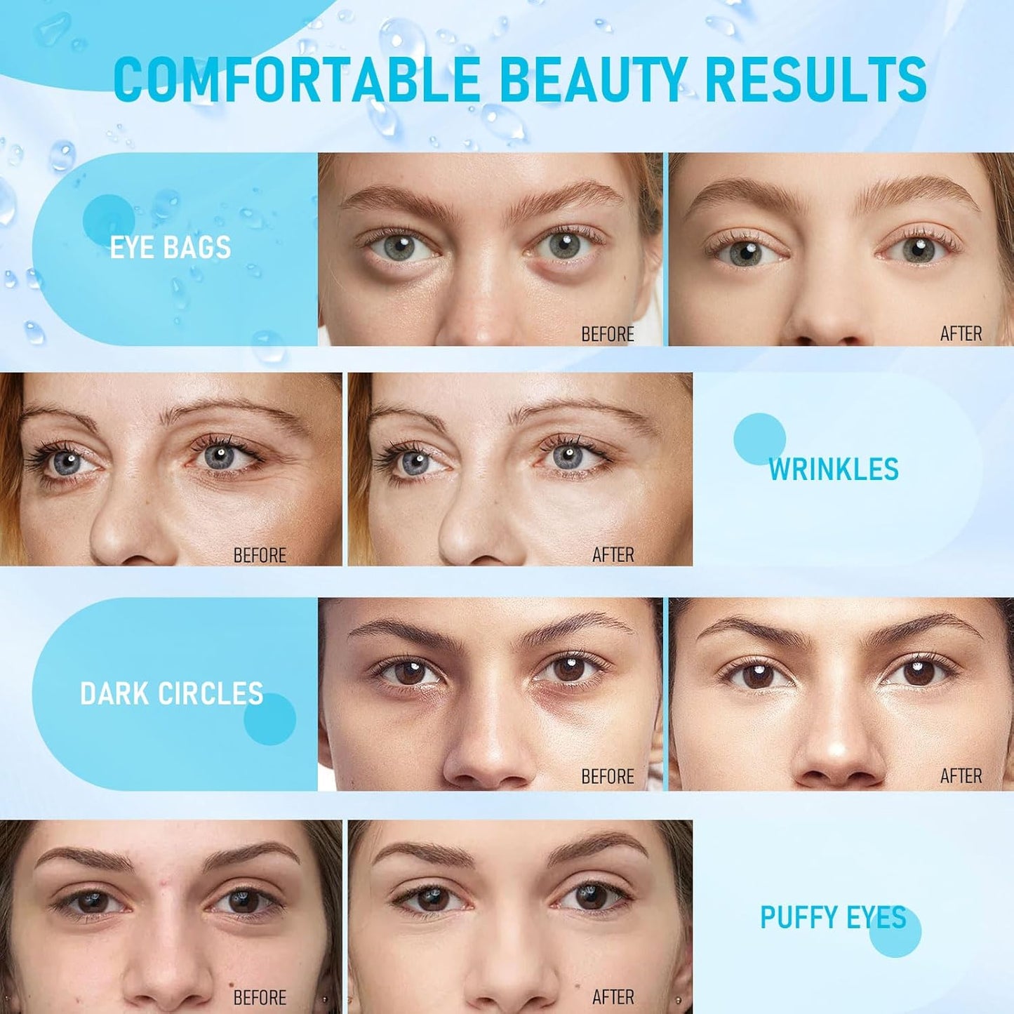 LAVONE Under Eye Patches-30 Pairs Hydrating & Anti-aging Eye Mask Skin Care for Dark Circles and Puffiness,Reduce Wrinkles,Eye Bags and Fine Lines,Eye Masks for Women and Man,with Hair Clips