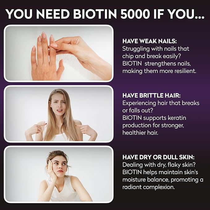Biotin 5000Mcg - High Potency Biotin Supplement for Hair Growth - Hair Skin Nails Vitamins for Women - Supports Keratin Production and Tissue Regeneration - Vitamins and Supplements - 30 Capsules