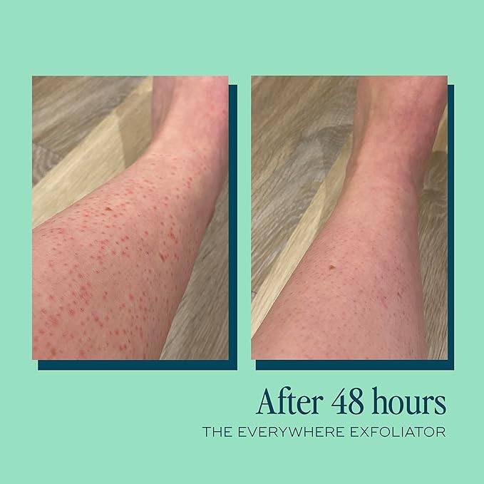 Gentle Body Exfoliator | Hydrating Acid-Based Scrub for Women | With Glycolic Acid, Lactic Acid, Rice Powder & Vitamin E | Smooths, Softens & Evens Tone | pH-Balanced & Vegan, 180ml