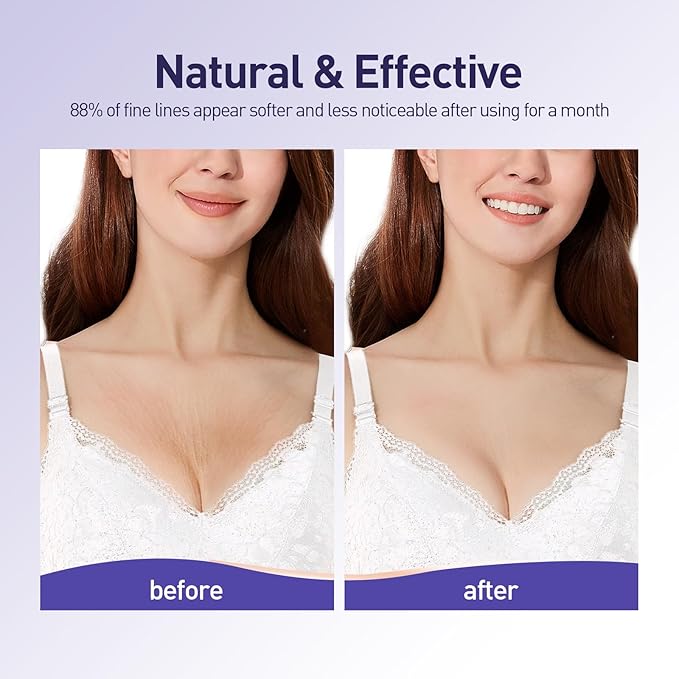 Silicone Chest Wrinkle Patches Reusable, Chest Pads for wrinkles Overnight, Safe Anti Wrinkle, Wrinkle Reducing Patche, 2 Patches