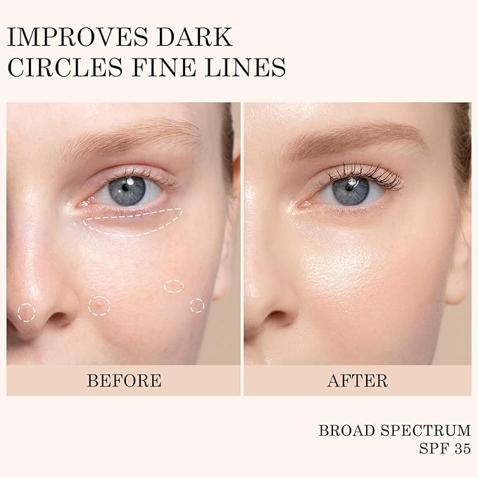 KYDA Mineral Sunscreen Eye Cream, 3-in-1 Anti-Aging Eye Cream, SPF 35, for Dark Circle and Fine Lines, Light