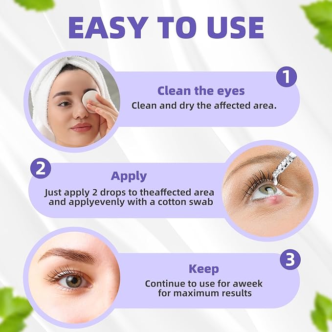Stye Eye Treatment, Natural Relief Drops Serum for Styes Chalazion and Blepharitis, Fast Chalazion Remover for Restore Healthier Eye Skin (1 Fl Oz (Pack of 1), Original)