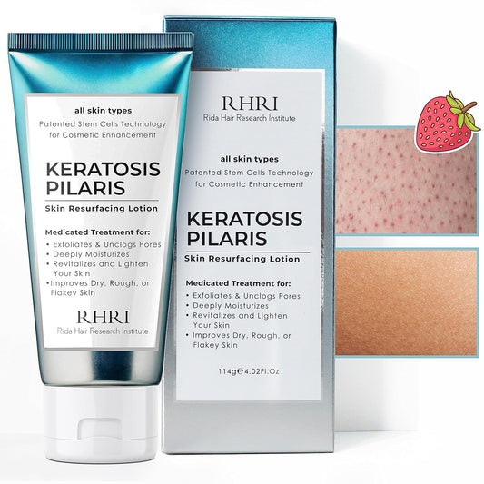 Keratosis Pilaris Treatment | Keratosis Pilaris Lotion | KP Lotion | Gentle Exfoliation For Strawberry Legs, KP & Ingrown Hairs | Smooth & Hydrating Body Lotion For Redness, Dry, Rough And Flaky Skin