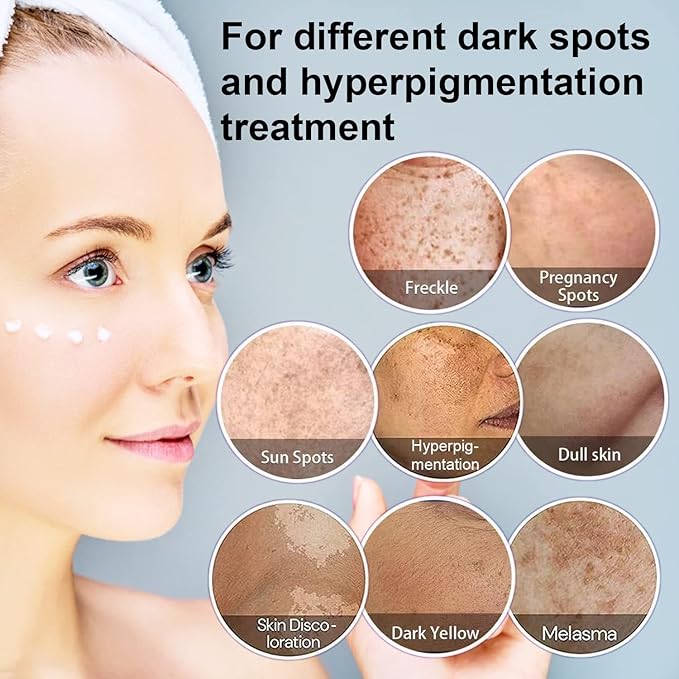 Dark Spot Remover for Face, Hyperpigmentation Treatment, Melasma, Freckle, Sun Spots Removal for All Skin Types Dark Spot Corrector for Men and Women